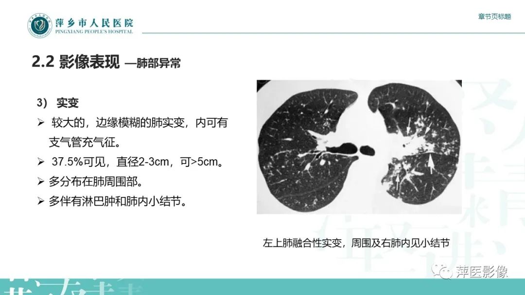 影像PPT - 【PPT】肺结节病-13
