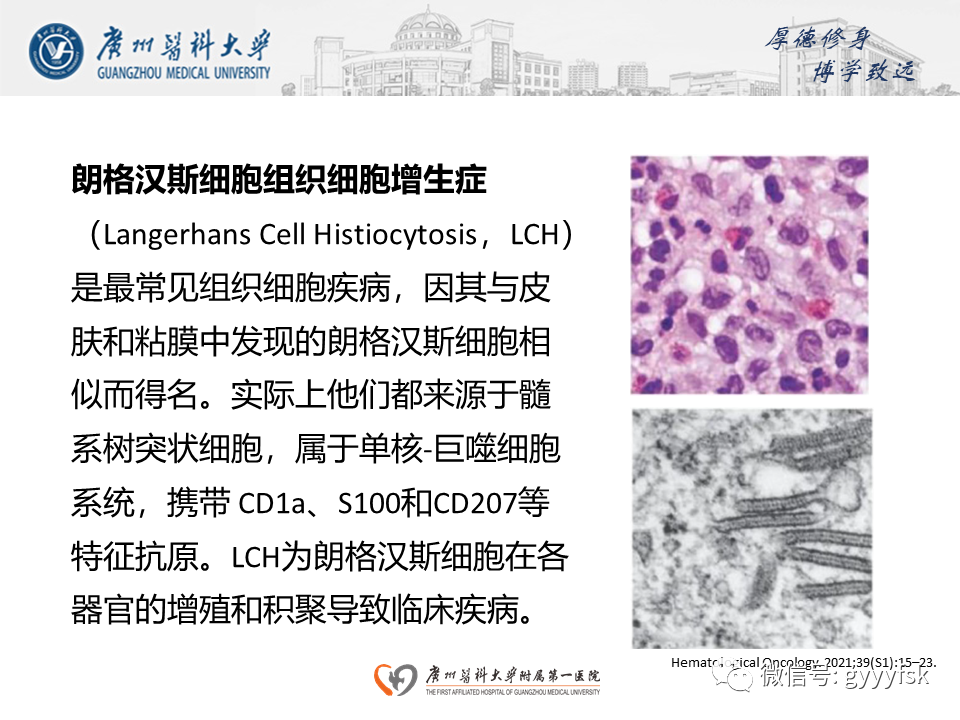 影像PPT - 【PPT】朗格汉斯细胞组织细胞增生症系统性影像表现-4