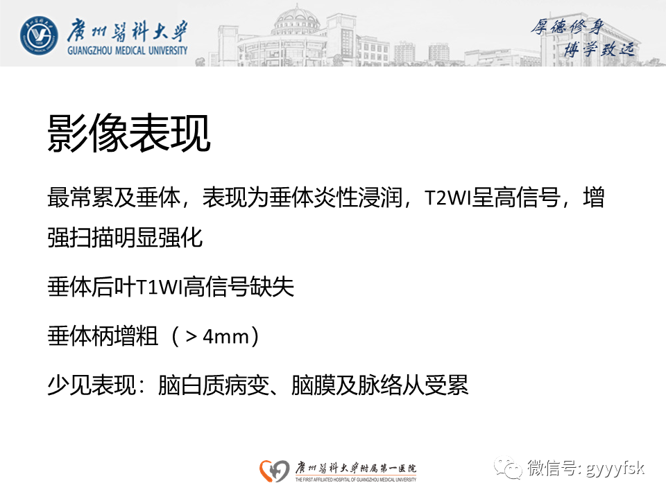 影像PPT - 【PPT】朗格汉斯细胞组织细胞增生症系统性影像表现-24