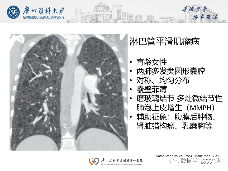 影像PPT - 【PPT】朗格汉斯细胞组织细胞增生症系统性影像表现-35