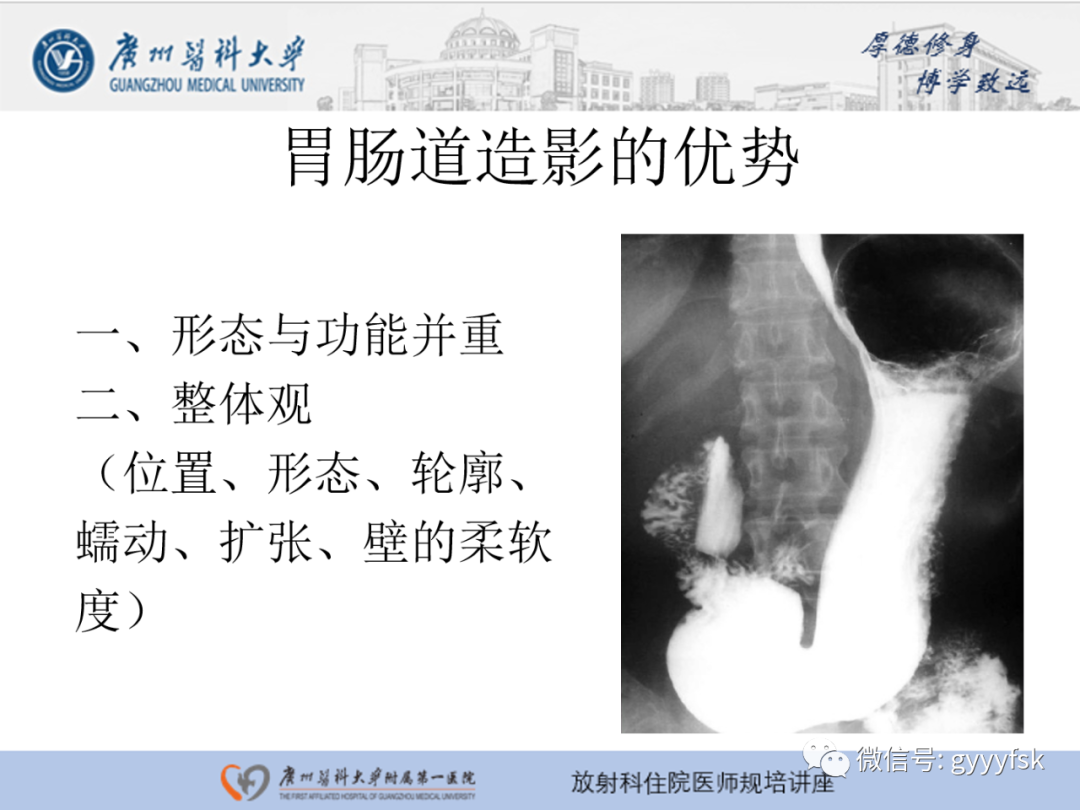 影像PPT - 【PPT】胃肠道造影检查-6