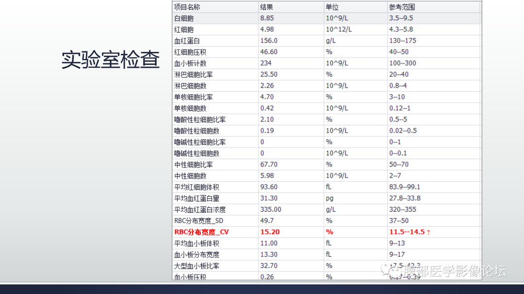 影像PPT - 【病例】多中心肝细胞肝癌HCC一例CT影像-3