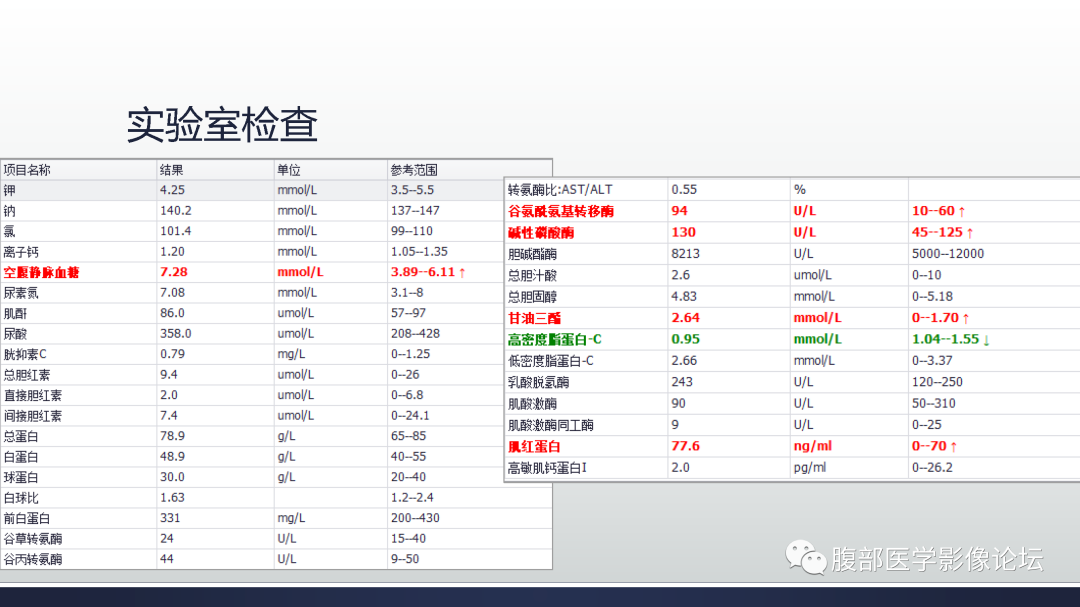 影像PPT - 【病例】多中心肝细胞肝癌HCC一例CT影像-4