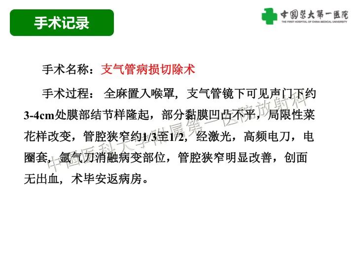 影像PPT - 【病例】气管腺样囊性癌1例CT影像-6