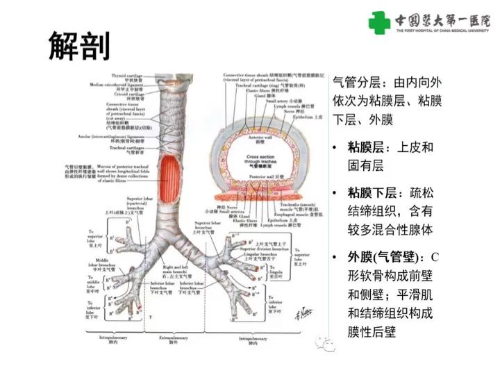 影像PPT - 【病例】气管腺样囊性癌1例CT影像-8