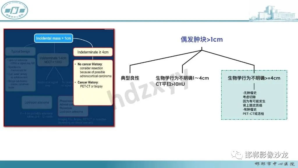 影像PPT - 【病例】肾上腺平滑肌肉瘤1例MR影像-28 影像PPT - 【病例】肾上腺平滑肌肉瘤1例MR影像-28