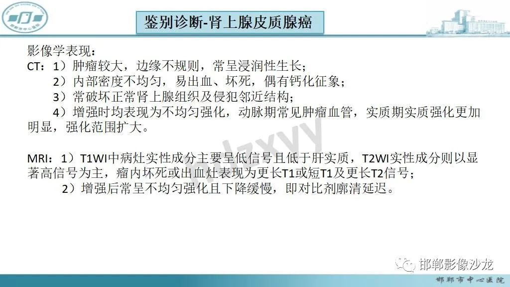 影像PPT - 【病例】肾上腺平滑肌肉瘤1例MR影像-31 影像PPT - 【病例】肾上腺平滑肌肉瘤1例MR影像-31
