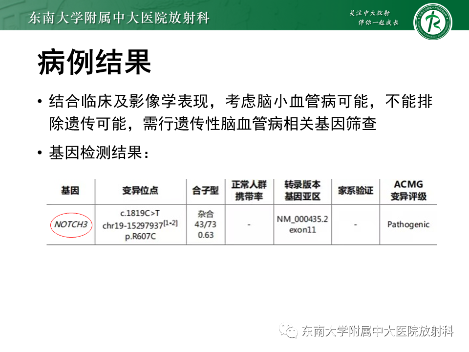 影像PPT - 【PPT】伴有皮质下梗死和白质脑病的常染色体显性遗传性脑动脉病(CADASIL)-3