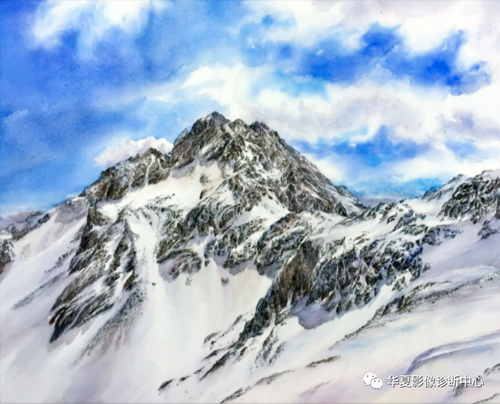 影像PPT - “雪山征”—CADASIL-2 影像PPT - “雪山征”—CADASIL-2