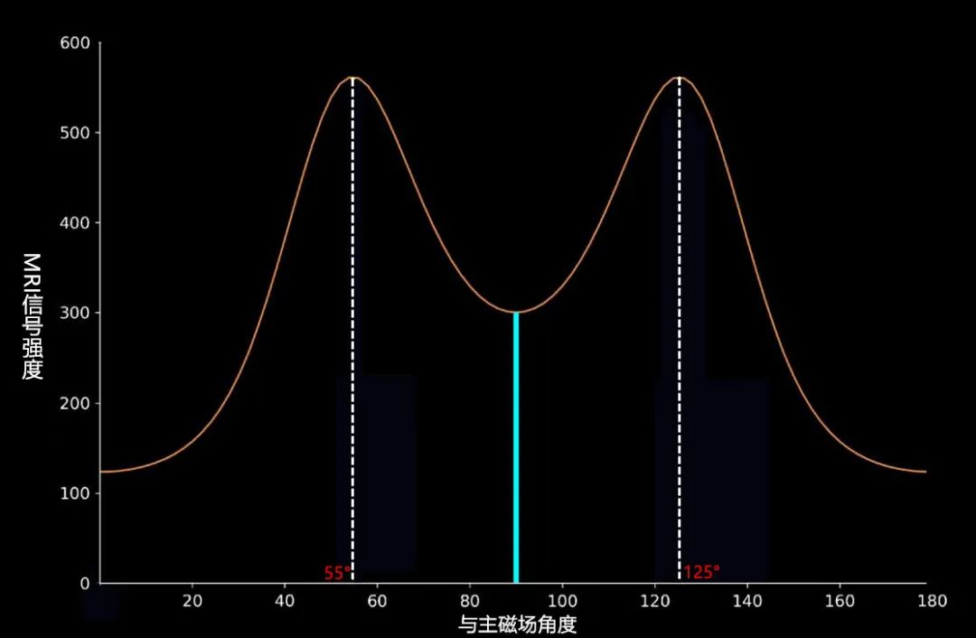 影像PPT - 临床扫描中遇到魔角效应该怎么办?-3 影像PPT - 临床扫描中遇到魔角效应该怎么办?-3