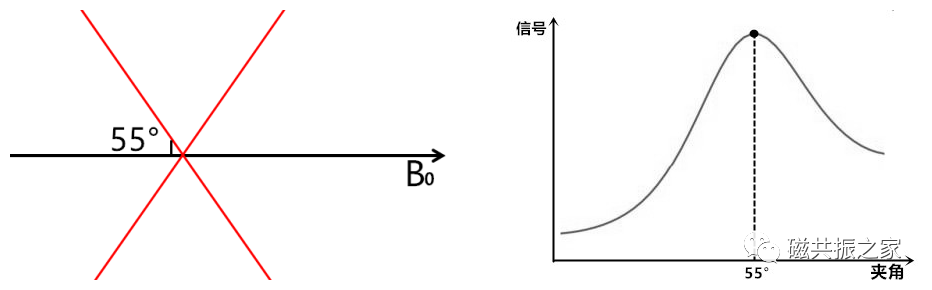 影像PPT - 临床扫描中遇到魔角效应该怎么办?-2 影像PPT - 临床扫描中遇到魔角效应该怎么办?-2