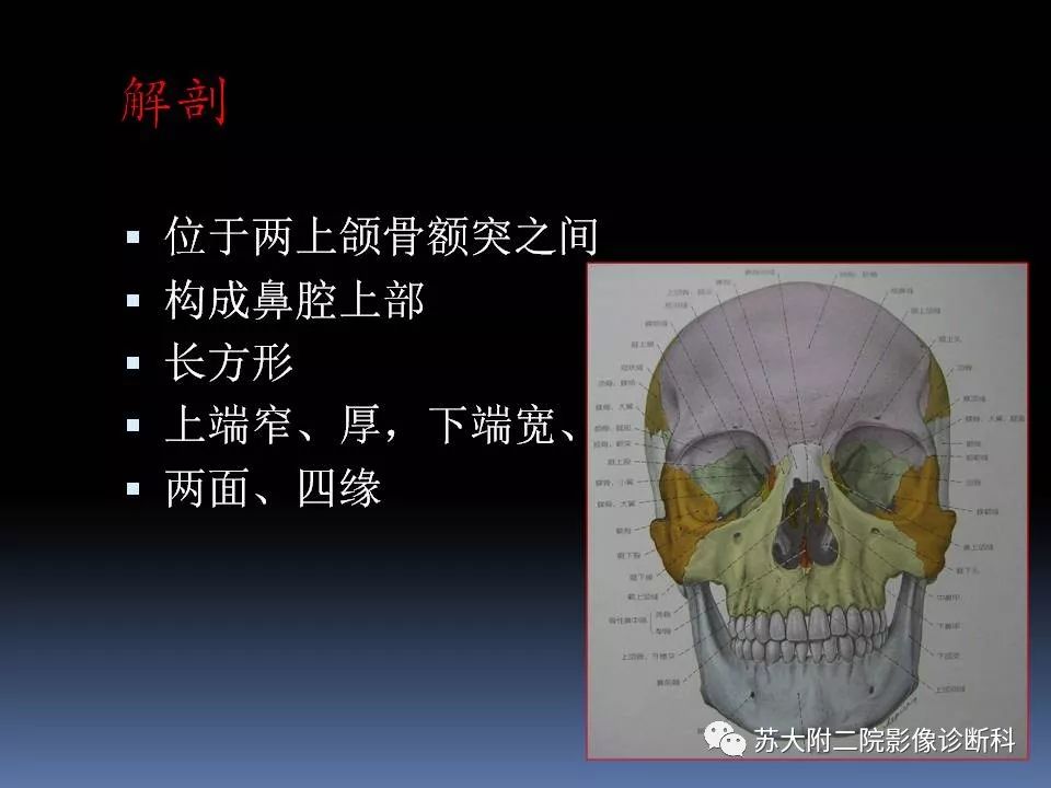 影像PPT - 【PPT】鼻骨骨折影像诊断误区-3