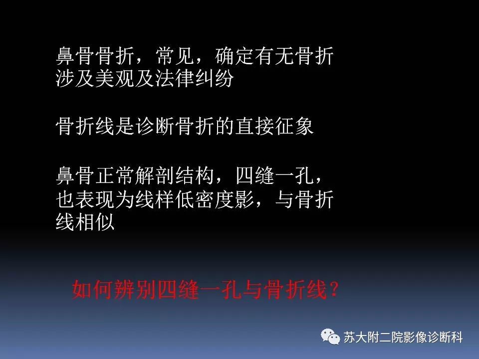 影像PPT - 【PPT】鼻骨骨折影像诊断误区-2