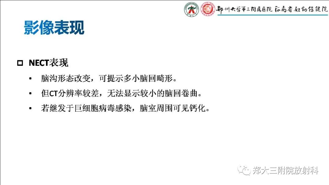 影像PPT - 【PPT】多小脑回畸形的影像表现-4