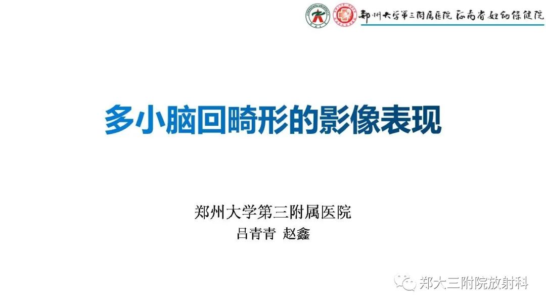 影像PPT - 【PPT】多小脑回畸形的影像表现-1