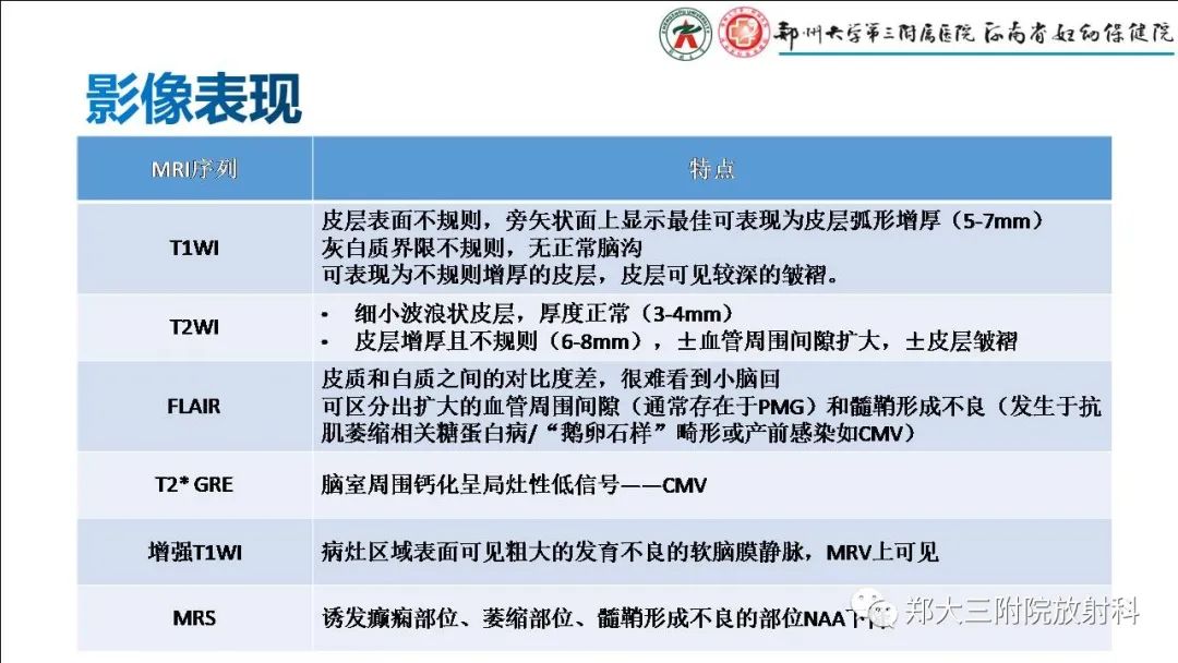 影像PPT - 【PPT】多小脑回畸形的影像表现-5