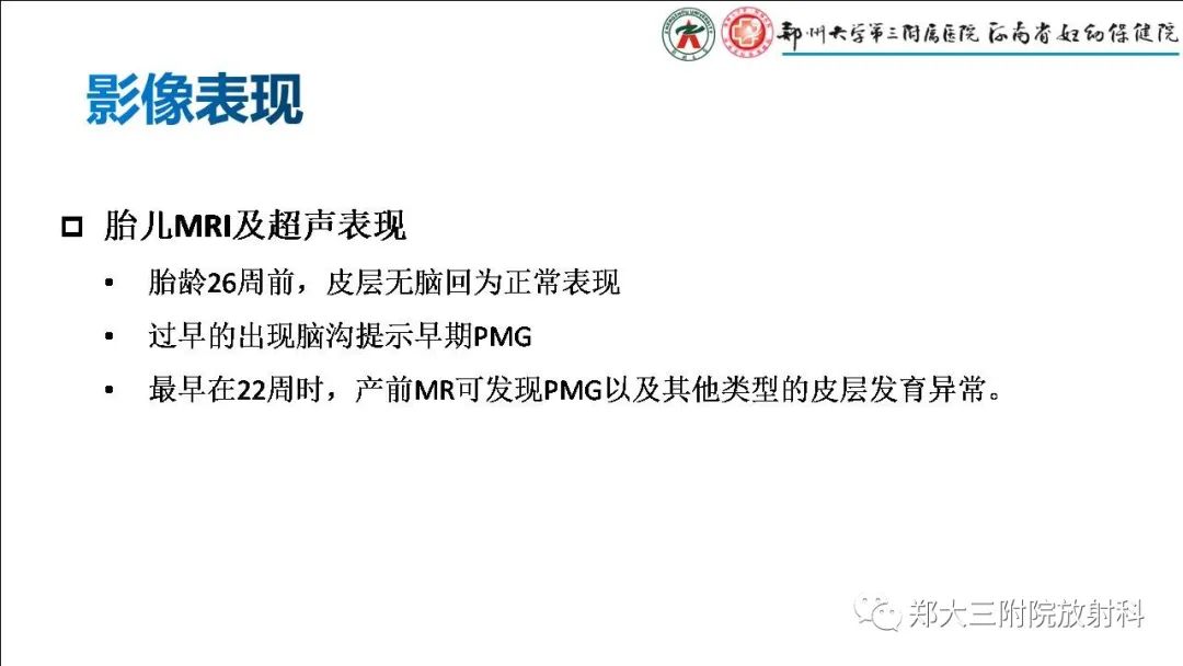 影像PPT - 【PPT】多小脑回畸形的影像表现-6