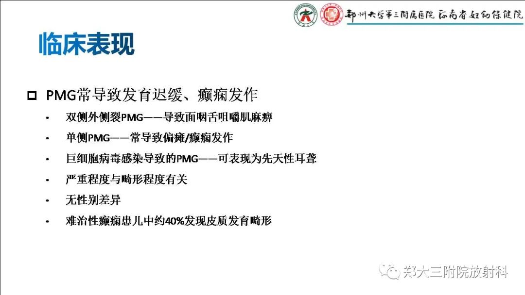 影像PPT - 【PPT】多小脑回畸形的影像表现-11