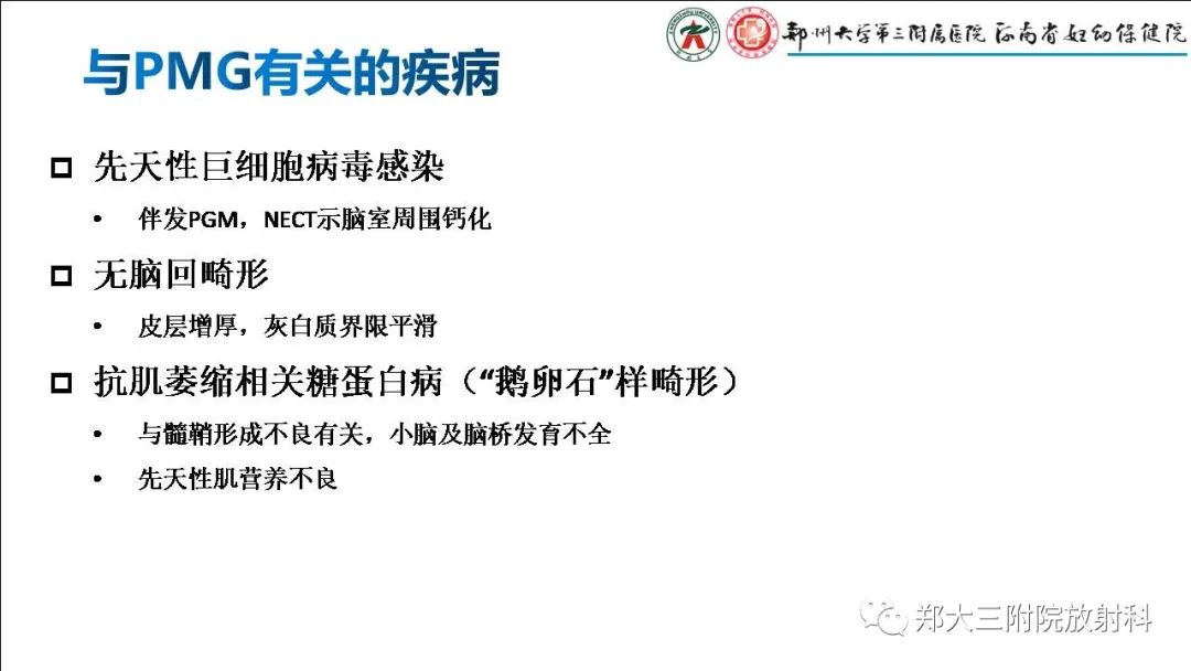 影像PPT - 【PPT】多小脑回畸形的影像表现-14