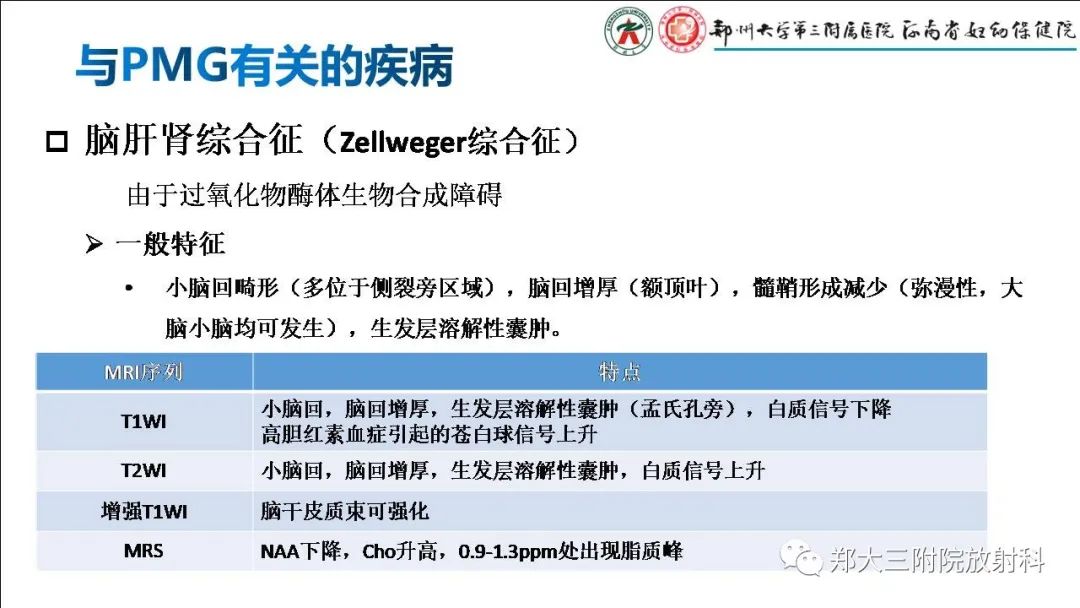 影像PPT - 【PPT】多小脑回畸形的影像表现-15