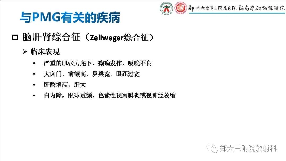 影像PPT - 【PPT】多小脑回畸形的影像表现-16