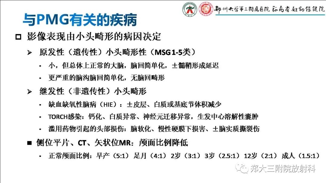 影像PPT - 【PPT】多小脑回畸形的影像表现-19