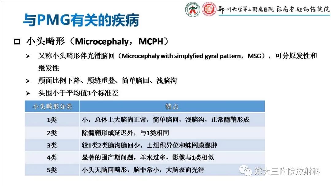 影像PPT - 【PPT】多小脑回畸形的影像表现-18