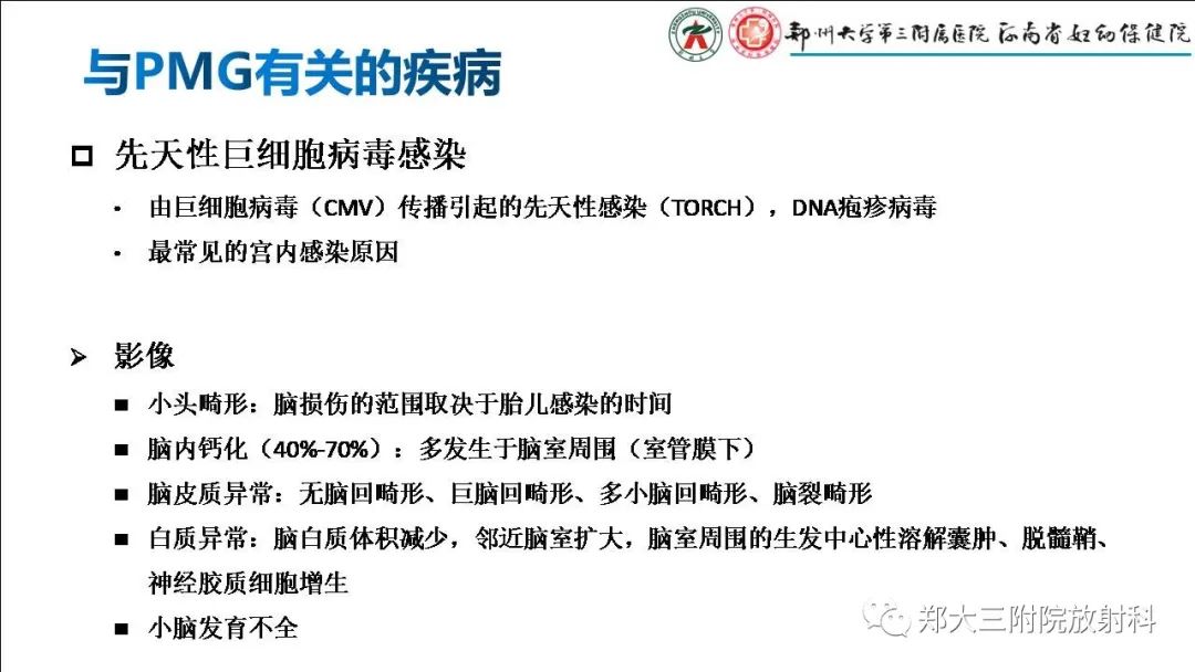影像PPT - 【PPT】多小脑回畸形的影像表现-25