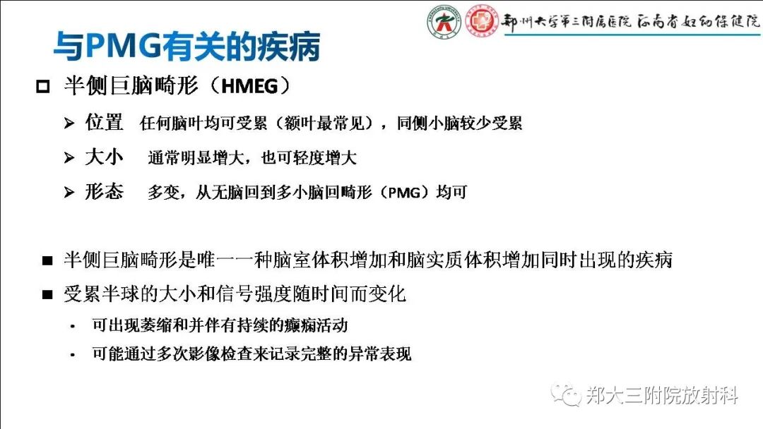 影像PPT - 【PPT】多小脑回畸形的影像表现-23