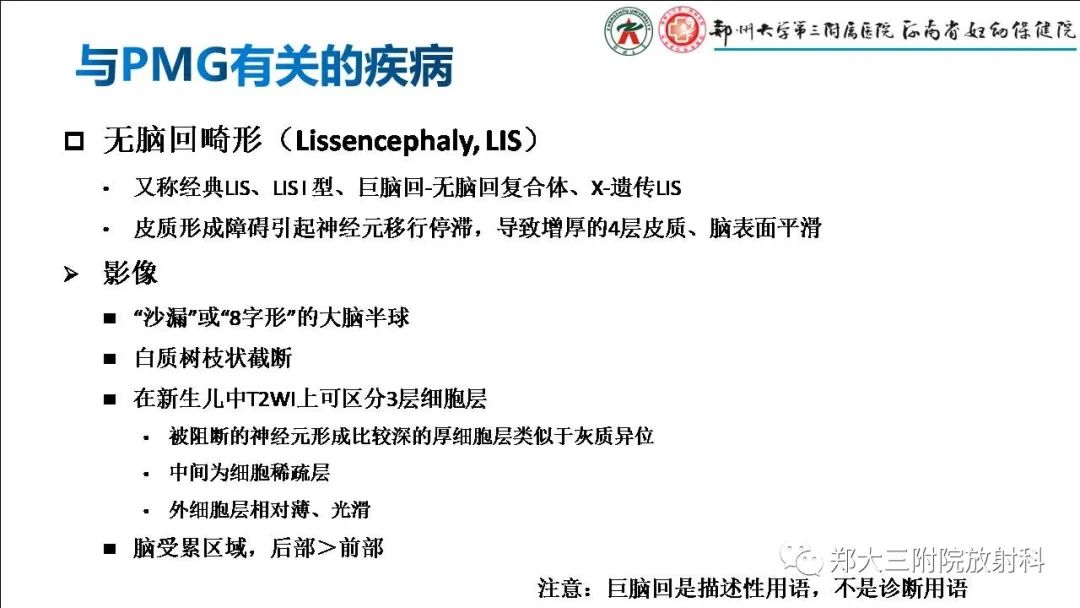 影像PPT - 【PPT】多小脑回畸形的影像表现-28