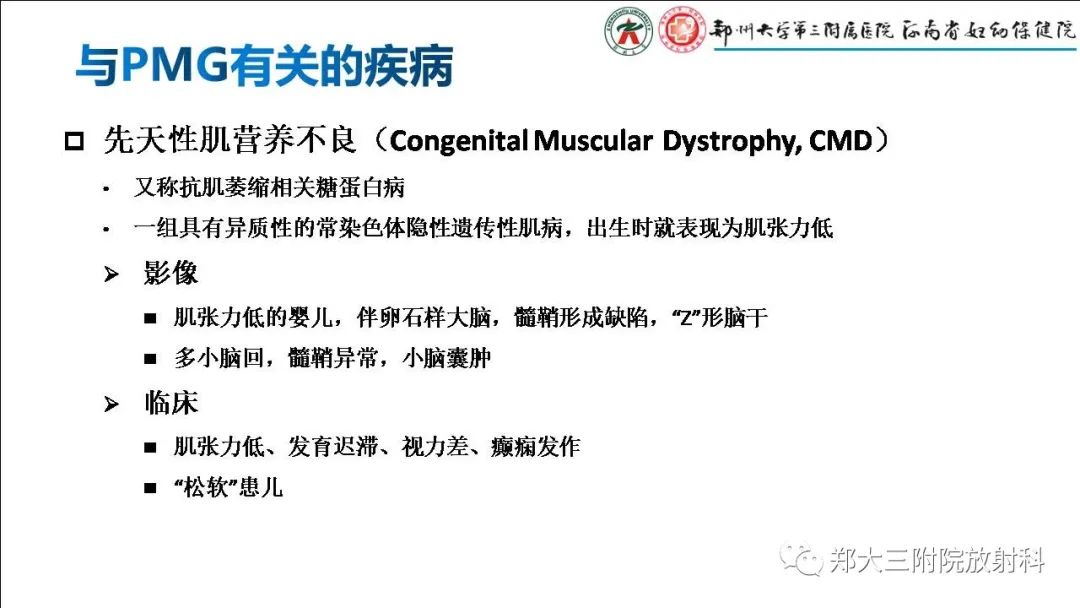 影像PPT - 【PPT】多小脑回畸形的影像表现-30