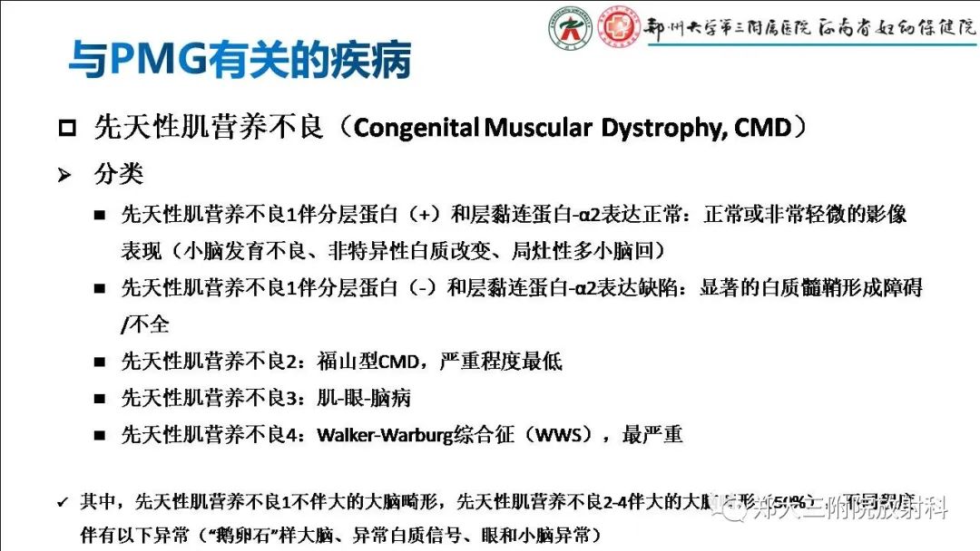 影像PPT - 【PPT】多小脑回畸形的影像表现-31