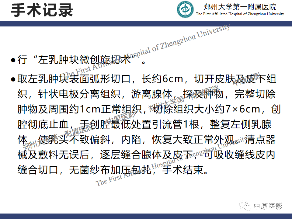 影像PPT - 【病例】乳腺交界性叶状肿瘤1例影像-12