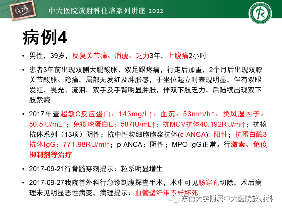 影像PPT - 【PPT】肝脏出血性病变的影像诊断及鉴别诊断-27