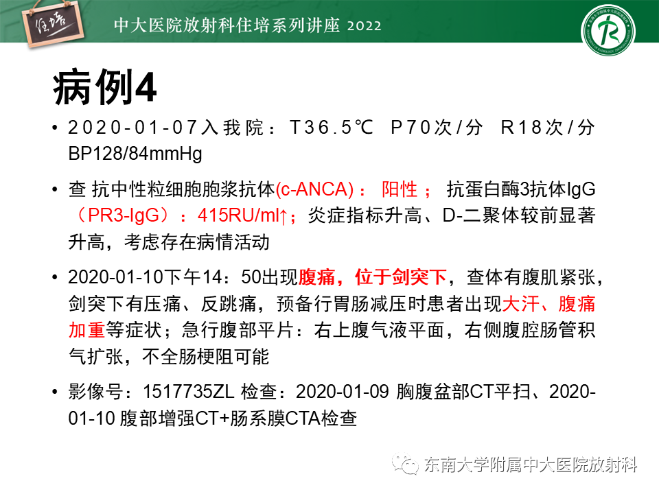 影像PPT - 【PPT】肝脏出血性病变的影像诊断及鉴别诊断-28