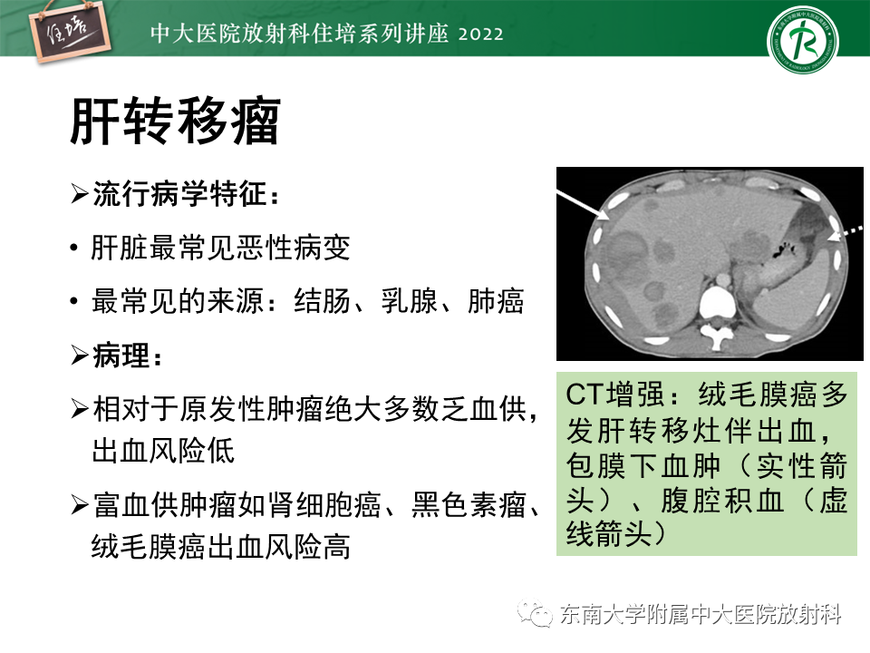影像PPT - 【PPT】肝脏出血性病变的影像诊断及鉴别诊断-45