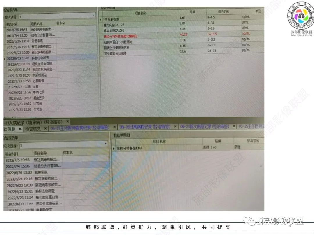 影像PPT - 【病例】肺部硕大块影一定想到它!-3 影像PPT - 【病例】肺部硕大块影一定想到它!-3