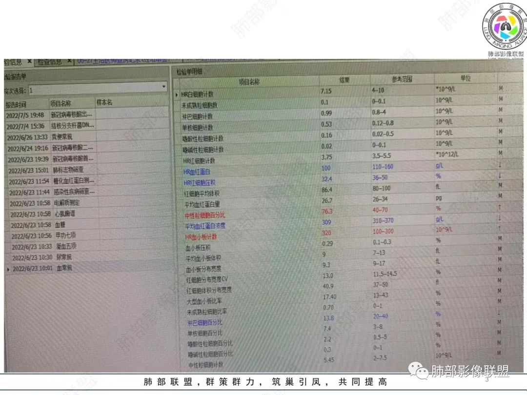 影像PPT - 【病例】肺部硕大块影一定想到它!-4 影像PPT - 【病例】肺部硕大块影一定想到它!-4