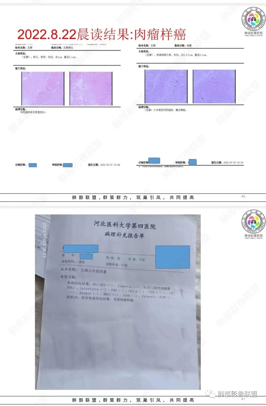 影像PPT - 【病例】肺部硕大块影一定想到它!-57 影像PPT - 【病例】肺部硕大块影一定想到它!-57