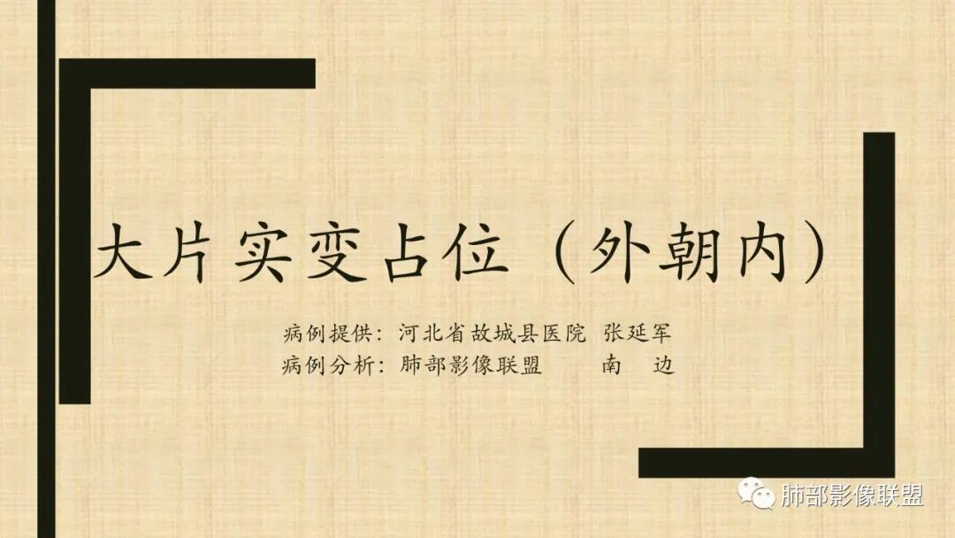 影像PPT - 【病例】肺部硕大块影一定想到它!-58 影像PPT - 【病例】肺部硕大块影一定想到它!-58