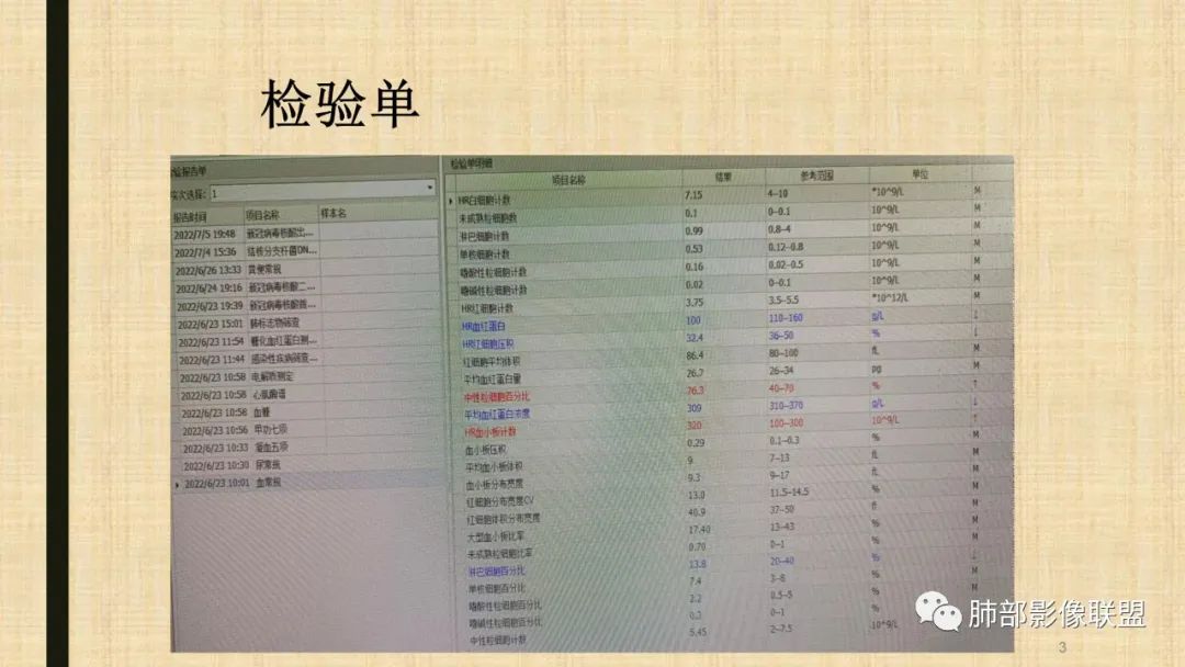 影像PPT - 【病例】肺部硕大块影一定想到它!-60 影像PPT - 【病例】肺部硕大块影一定想到它!-60