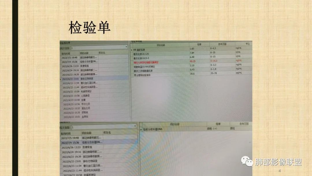 影像PPT - 【病例】肺部硕大块影一定想到它!-61 影像PPT - 【病例】肺部硕大块影一定想到它!-61