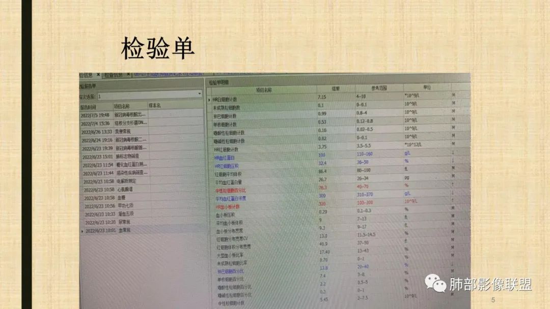 影像PPT - 【病例】肺部硕大块影一定想到它!-62 影像PPT - 【病例】肺部硕大块影一定想到它!-62