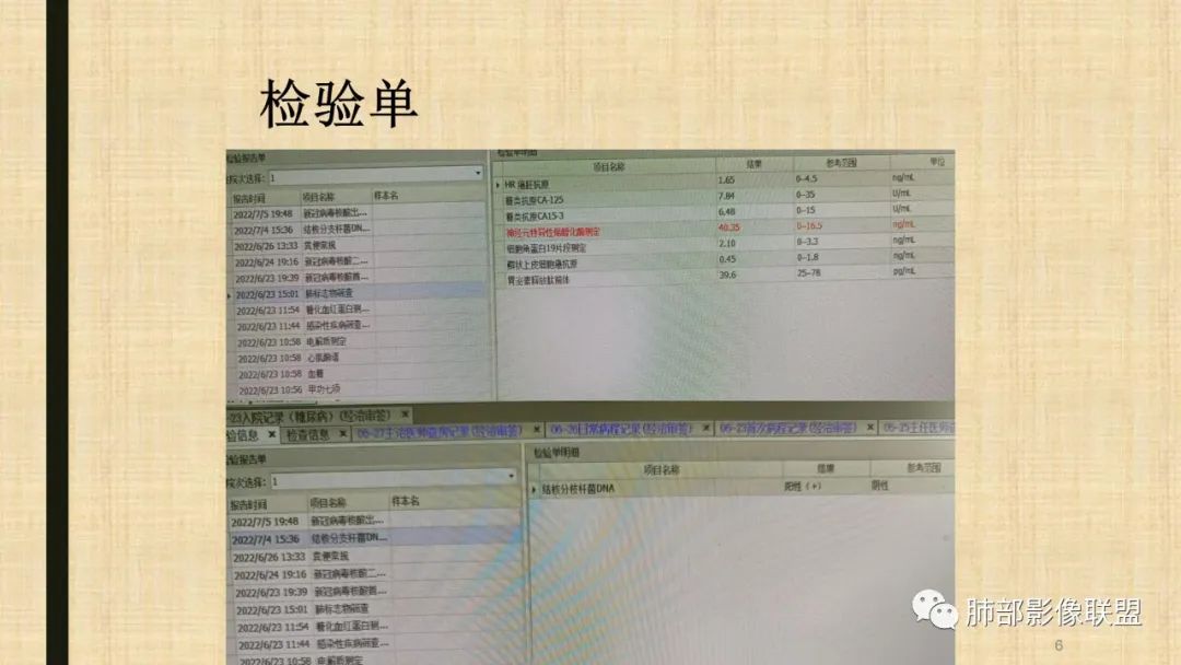 影像PPT - 【病例】肺部硕大块影一定想到它!-63 影像PPT - 【病例】肺部硕大块影一定想到它!-63
