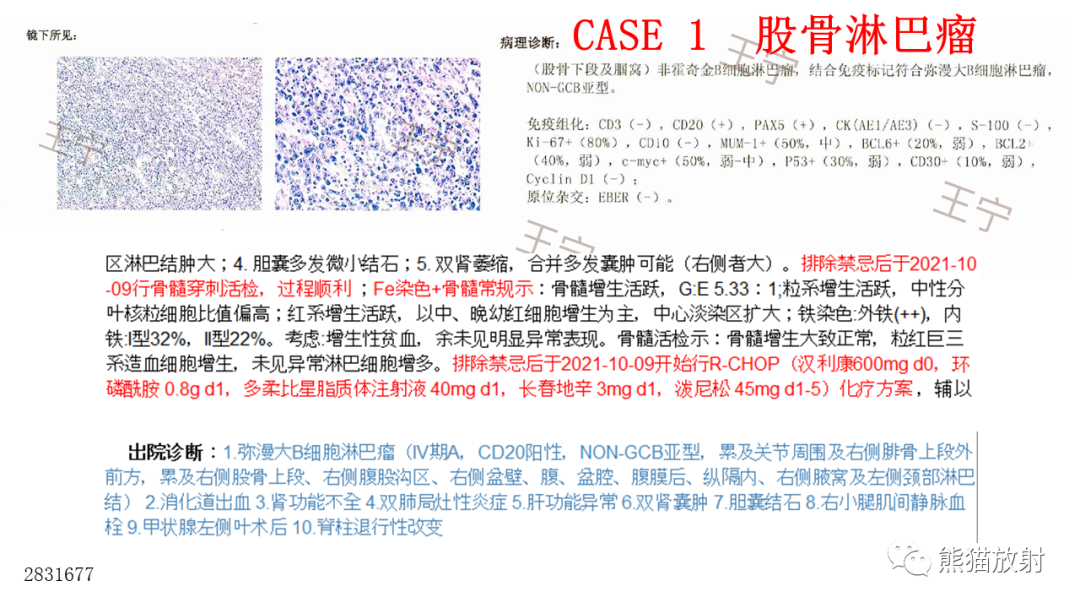 影像PPT - 【病例】股骨淋巴瘤 VS 股骨转移瘤-12