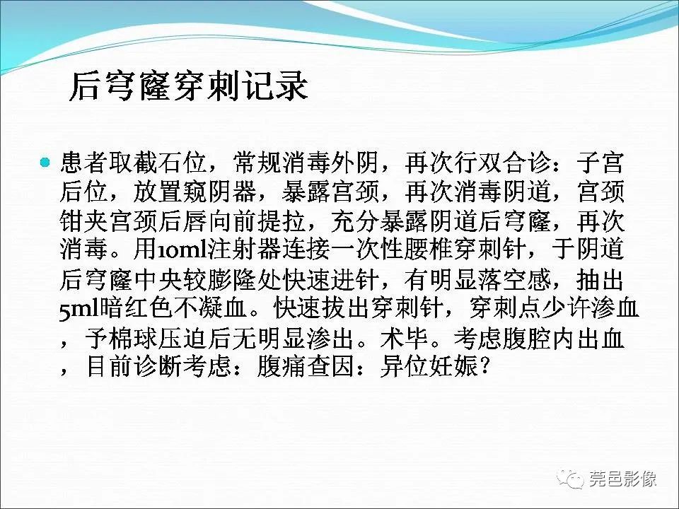 影像PPT - 【病例】输卵管妊娠破裂1例B超及CT影像-9