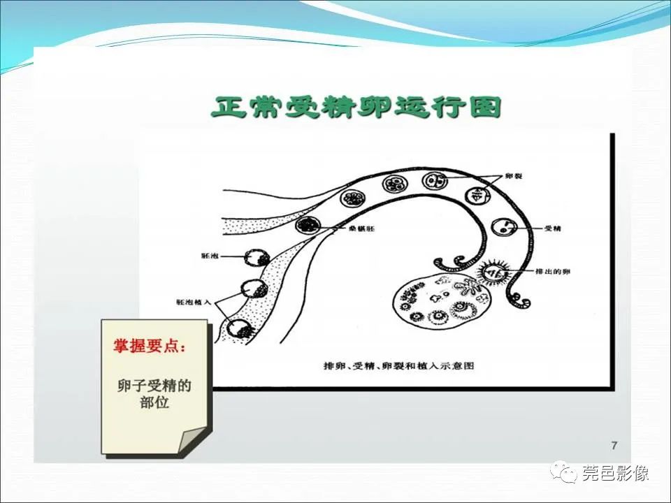 影像PPT - 【病例】输卵管妊娠破裂1例B超及CT影像-19