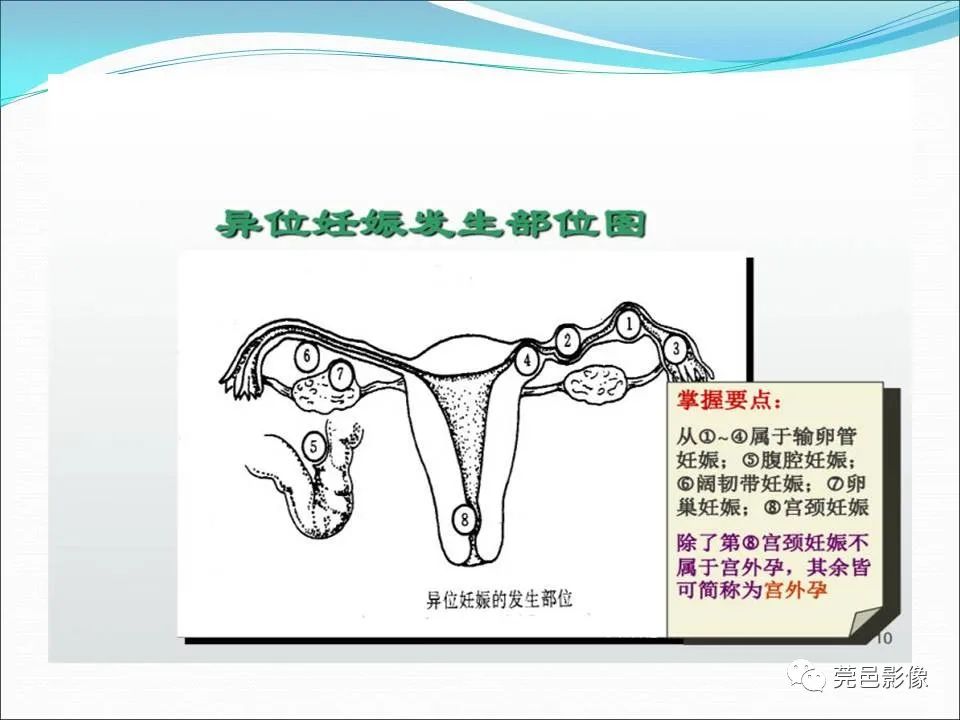 影像PPT - 【病例】输卵管妊娠破裂1例B超及CT影像-20