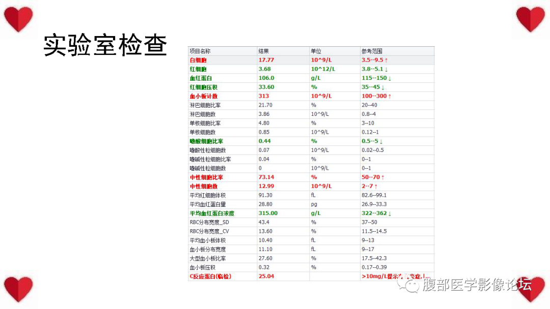 影像PPT - 【病例】子宫内膜样癌1例CT及MR影像-3