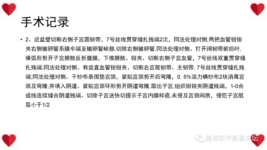 影像PPT - 【病例】子宫内膜样癌1例CT及MR影像-35